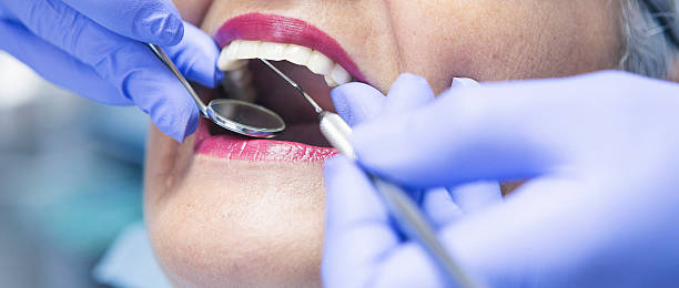 Best Emergency Dental Care for Broken or Chipped Teeth in Sayre, PA